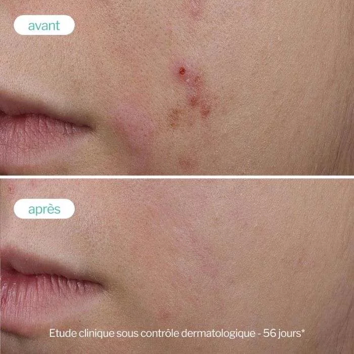 NOVEXPERT SERUM BOOSTER TRIO ZINC 30ML